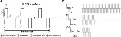 High-frequency irreversible electroporation improves survival and immune cell infiltration in rodents with malignant gliomas